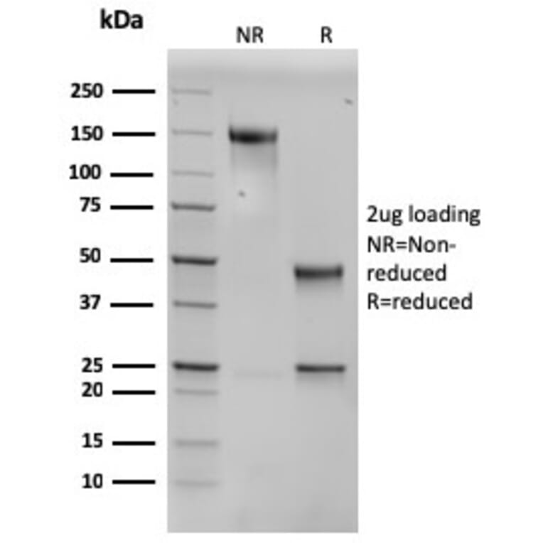 SDS-PAGE - Anti-SERBP1 Antibody [SERBP1/3496] - BSA and Azide free (A251869) - Antibodies.com