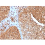 Immunohistochemistry - Anti-SERBP1 Antibody [SERBP1/3497] - BSA and Azide free (A251870) - Antibodies.com