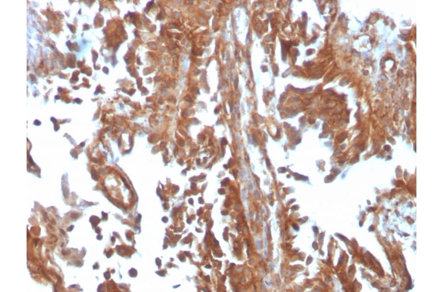Immunohistochemistry - Anti-SERBP1 Antibody [SERBP1/3497] - BSA and Azide free (A251870) - Antibodies.com
