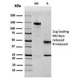 SDS-PAGE - Anti-SERBP1 Antibody [SERBP1/3497] - BSA and Azide free (A251870) - Antibodies.com