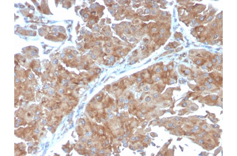 Immunohistochemistry - Anti-SERBP1 Antibody [SERBP1/3498] - BSA and Azide free (A251871) - Antibodies.com