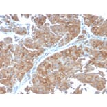 Immunohistochemistry - Anti-SERBP1 Antibody [SERBP1/3498] - BSA and Azide free (A251871) - Antibodies.com