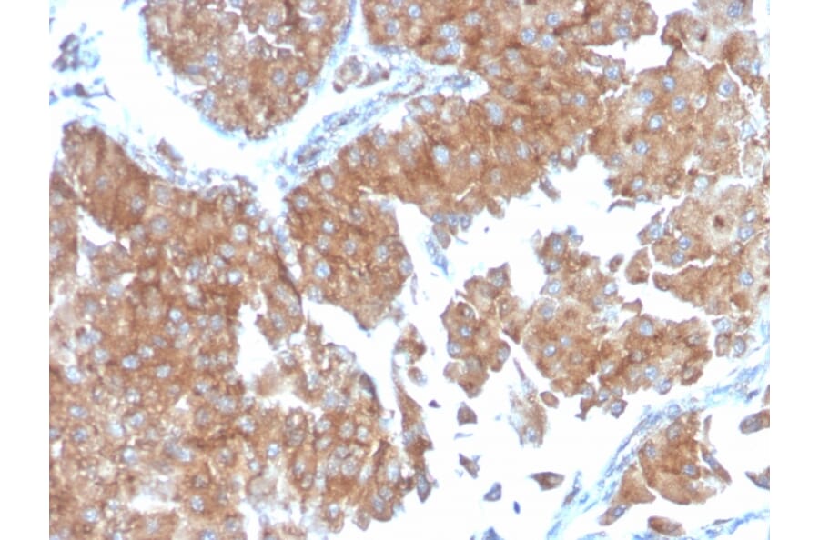 Immunohistochemistry - Anti-SERBP1 Antibody [SERBP1/3498] - BSA and Azide free (A251871) - Antibodies.com