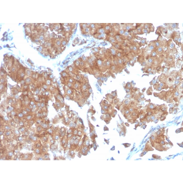 Immunohistochemistry - Anti-SERBP1 Antibody [SERBP1/3498] - BSA and Azide free (A251871) - Antibodies.com