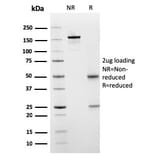 SDS-PAGE - Anti-SERBP1 Antibody [SERBP1/3498] - BSA and Azide free (A251871) - Antibodies.com