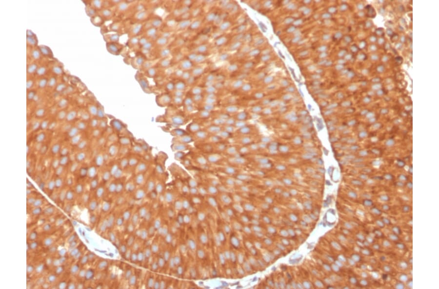 Immunohistochemistry - Anti-SERBP1 Antibody [SERBP1/3509] - BSA and Azide free (A251872) - Antibodies.com