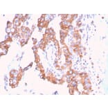 Immunohistochemistry - Anti-SERBP1 Antibody [SERBP1/3509] - BSA and Azide free (A251872) - Antibodies.com
