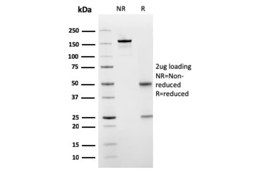 SDS-PAGE - Anti-SERBP1 Antibody [SERBP1/3509] - BSA and Azide free (A251872) - Antibodies.com