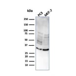 Western Blot - Anti-NKX2.8 Antibody [NKX28/2547] - BSA and Azide free (A251873) - Antibodies.com