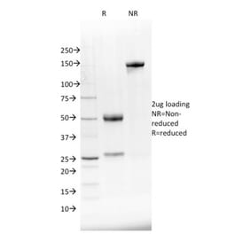 SDS-PAGE - Anti-NKX2.8 Antibody [NKX28/2548] - BSA and Azide free (A251873) - Antibodies.com