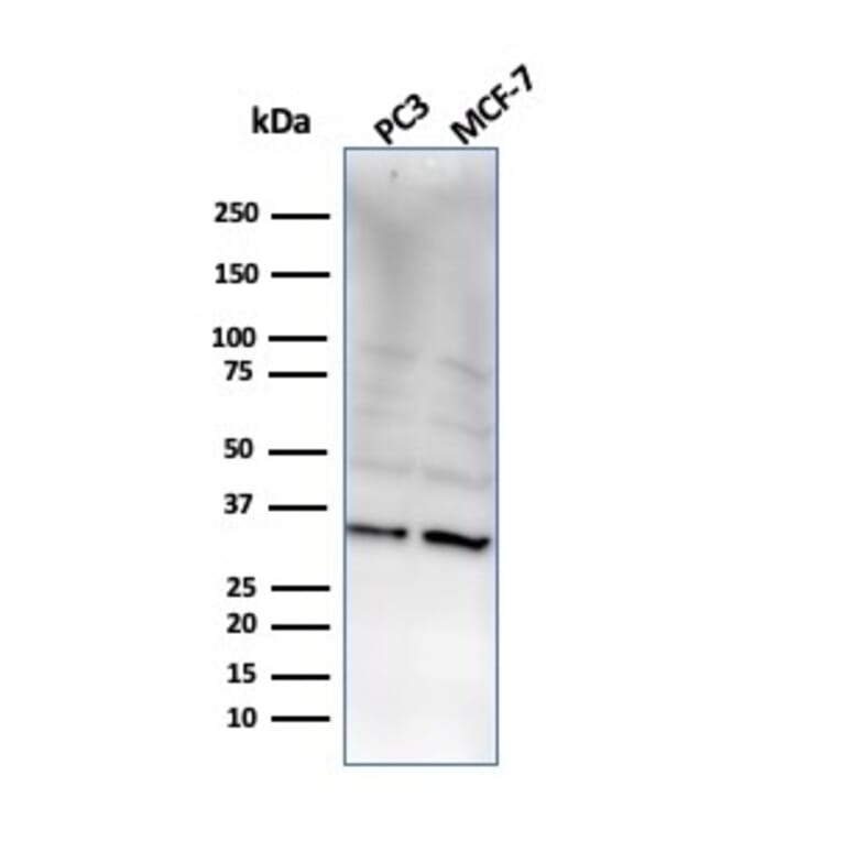 Western Blot - Anti-NKX2.8 Antibody [NKX28/2548] - BSA and Azide free (A251874) - Antibodies.com