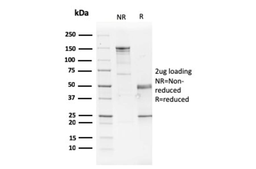 SDS-PAGE - Anti-GATA3 Antibody [GATA3/2442] - BSA and Azide free (A251877) - Antibodies.com