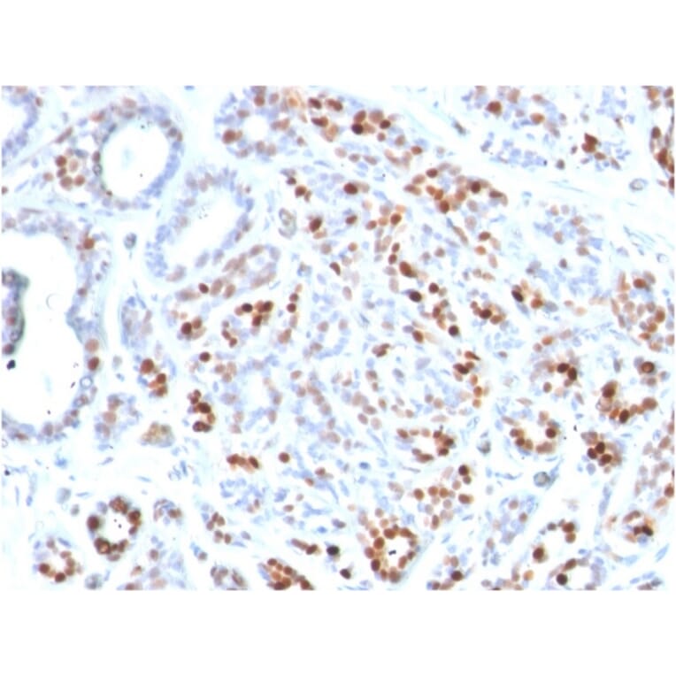 Immunohistochemistry - Anti-GATA3 Antibody [GATA3/2444] - BSA and Azide free (A251878) - Antibodies.com