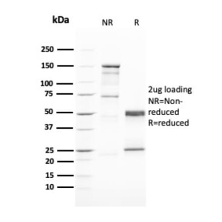 SDS-PAGE - Anti-GATA3 Antibody [GATA3/2446] - BSA and Azide free (A251879) - Antibodies.com