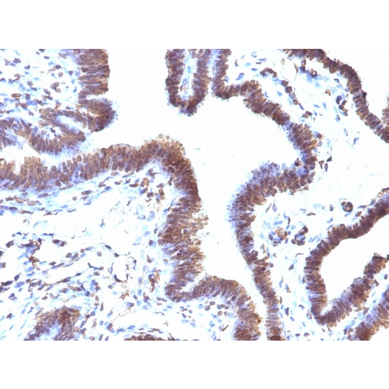 Immunohistochemistry - Anti-EMI1 Antibody [EMI1/1176] - BSA and Azide free (A251882) - Antibodies.com