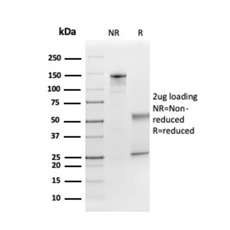 SDS-PAGE - Anti-FGF21 Antibody [FGF21/3691] - BSA and Azide free (A251883) - Antibodies.com