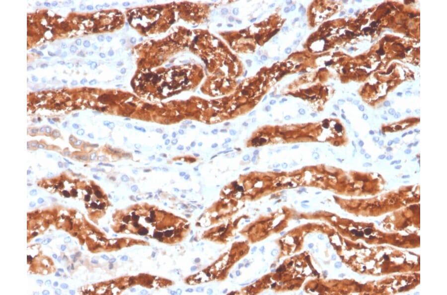 Immunohistochemistry - Anti-FGF21 Antibody [FGF21/3691] - BSA and Azide free (A251883) - Antibodies.com