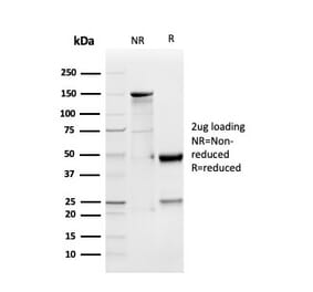SDS-PAGE - Anti-GDF9 Antibody [GDF9/4261] - BSA and Azide free (A251885) - Antibodies.com