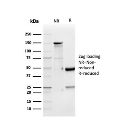 SDS-PAGE - Anti-GDF9 Antibody [GDF9/4261] - BSA and Azide free (A251885) - Antibodies.com