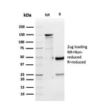 SDS-PAGE - Anti-GDF9 Antibody [GDF9/4261] - BSA and Azide free (A251885) - Antibodies.com