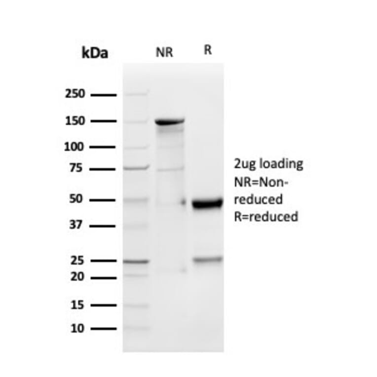 SDS-PAGE - Anti-GDF Antibody [GDF9/4262] - BSA and Azide free (A248704) - Antibodies.com
