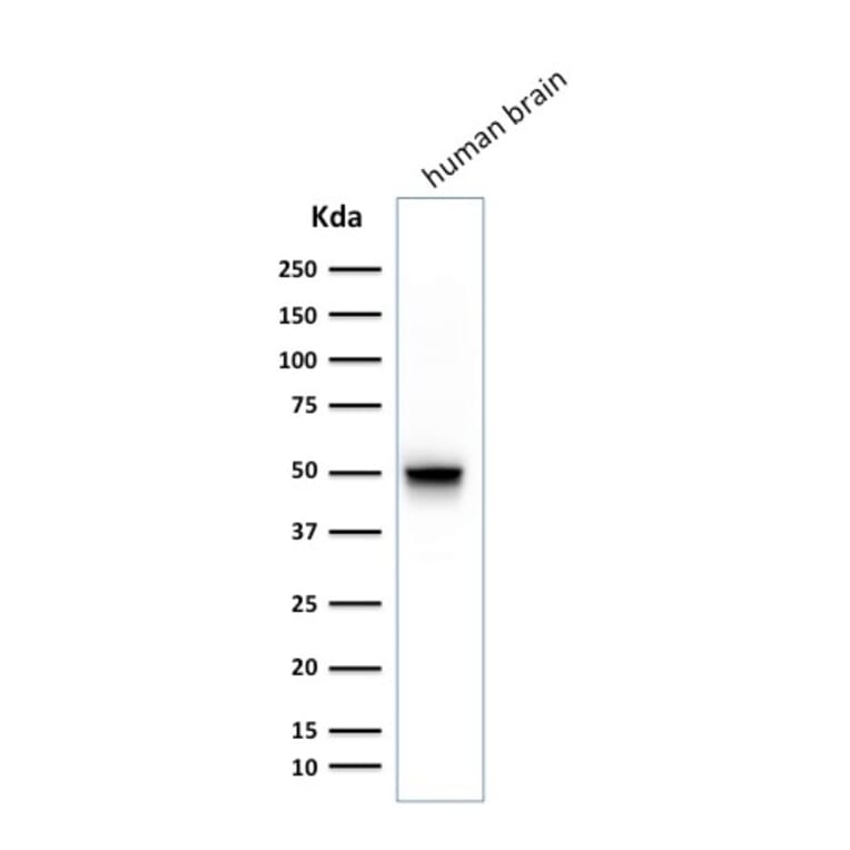 Western Blot - Anti-GFAP Antibody [SPM248] - BSA and Azide free (A251888) - Antibodies.com
