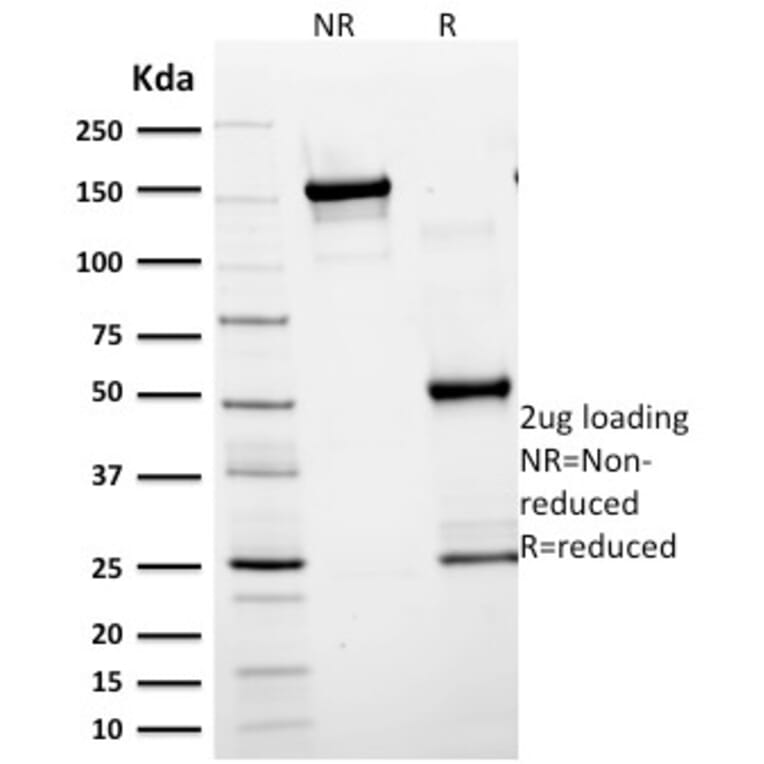 SDS-PAGE - Anti-GFAP Antibody [SPM248] - BSA and Azide free (A251888) - Antibodies.com