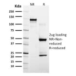 SDS-PAGE - Anti-GFAP Antibody [SPM507] - BSA and Azide free (A251889) - Antibodies.com