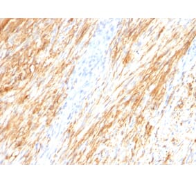 Immunohistochemistry - Anti-GFAP Antibody [ASTRO/789] - BSA and Azide free (A251890) - Antibodies.com