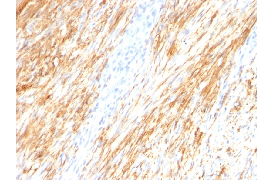 Immunohistochemistry - Anti-GFAP Antibody [ASTRO/789] - BSA and Azide free (A251890) - Antibodies.com