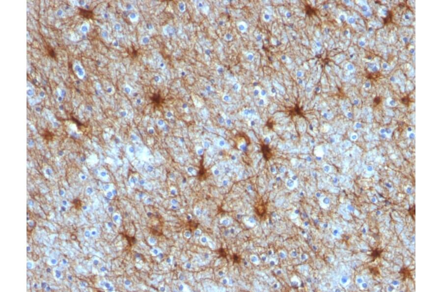 Immunohistochemistry - Anti-GFAP Antibody [ASTRO/789] - BSA and Azide free (A251889) - Antibodies.com