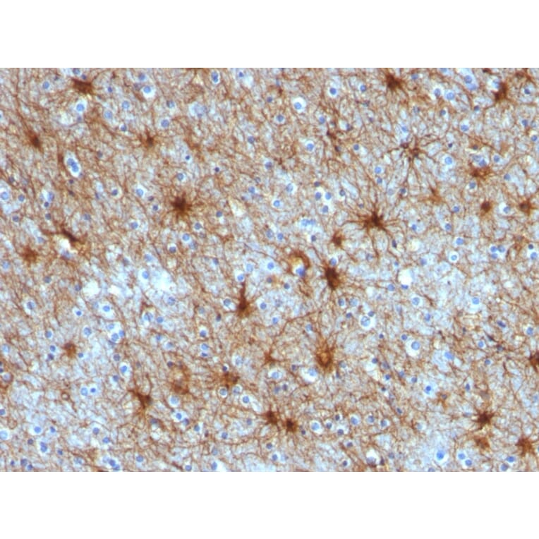 Immunohistochemistry - Anti-GFAP Antibody [ASTRO/789] - BSA and Azide free (A251889) - Antibodies.com