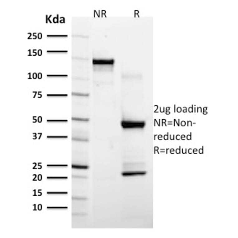 SDS-PAGE - Anti-GFAP Antibody [ASTRO/789] - BSA and Azide free (A251890) - Antibodies.com
