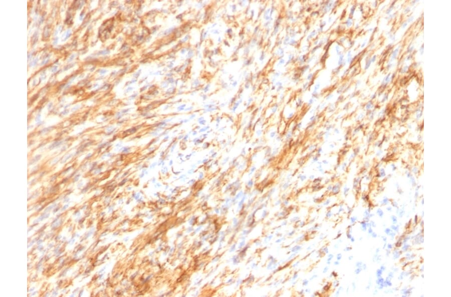 Immunohistochemistry - Anti-GFAP Antibody [GA-5 + ASTRO/789] - BSA and Azide free (A251891) - Antibodies.com