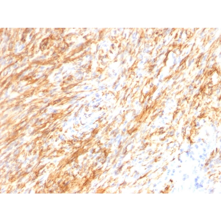 Immunohistochemistry - Anti-GFAP Antibody [GA-5 + ASTRO/789] - BSA and Azide free (A251891) - Antibodies.com