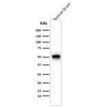 Western Blot - Anti-GFAP Antibody [GA-5 + ASTRO/789] - BSA and Azide free (A251891) - Antibodies.com