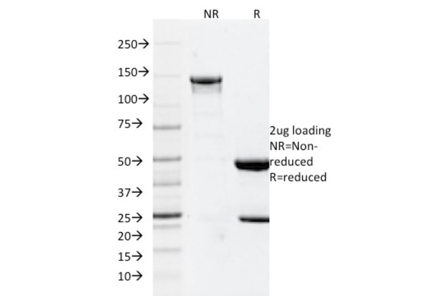 SDS-PAGE - Anti-GFAP Antibody [GFAP/2076] - BSA and Azide free (A251892) - Antibodies.com