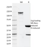 SDS-PAGE - Anti-GFAP Antibody [GFAP/2076] - BSA and Azide free (A251892) - Antibodies.com