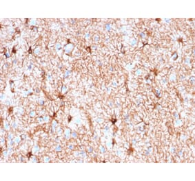 Immunohistochemistry - Anti-GFAP Antibody [rASTRO/789] - BSA and Azide free (A251893) - Antibodies.com