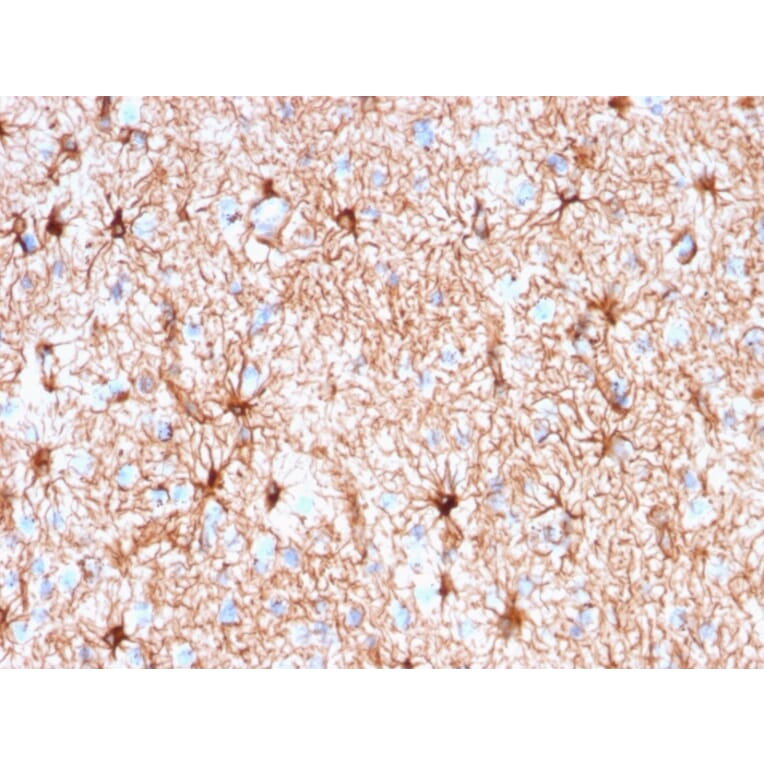 Immunohistochemistry - Anti-GFAP Antibody [rASTRO/789] - BSA and Azide free (A251893) - Antibodies.com