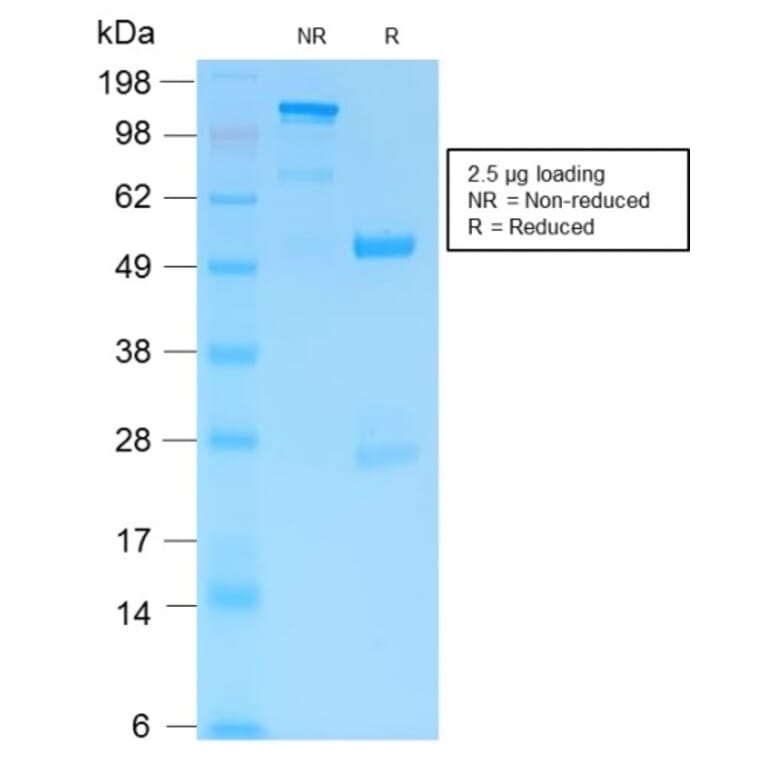 SDS-PAGE - Anti-GFAP Antibody [ASTRO/1974R] - BSA and Azide free (A251894) - Antibodies.com
