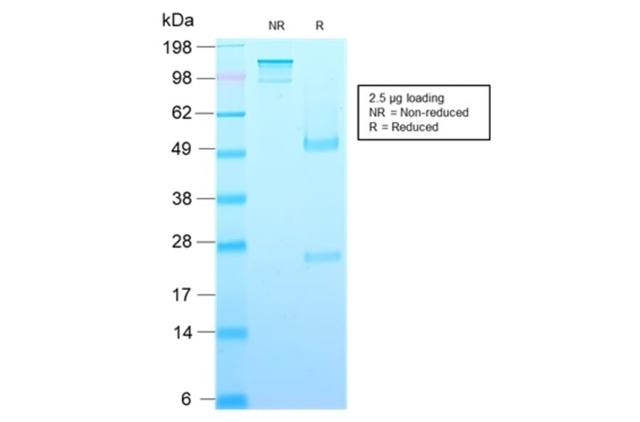 SDS-PAGE - Anti-Growth Hormone Antibody [rGH/1450] - BSA and Azide free (A251898) - Antibodies.com