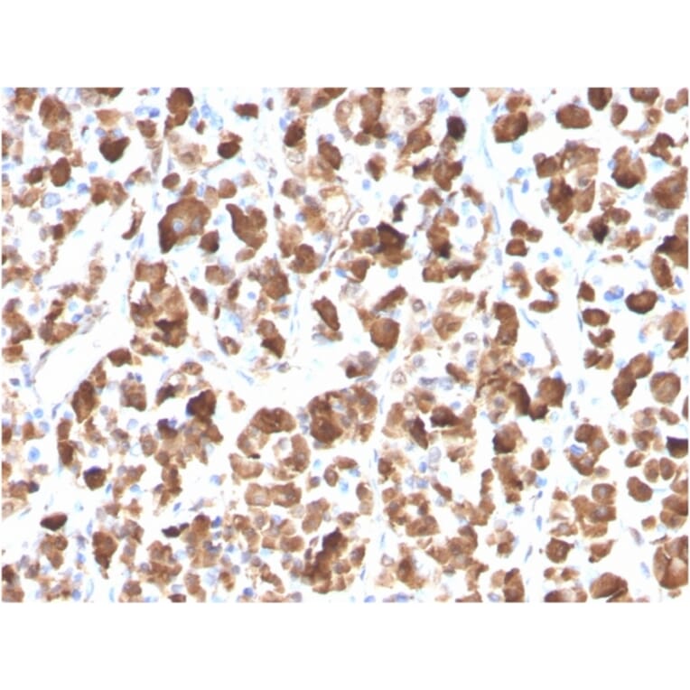 Immunohistochemistry - Anti-Growth Hormone Antibody [GH/3155] - BSA and Azide free (A251899) - Antibodies.com