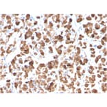 Immunohistochemistry - Anti-Growth Hormone Antibody [GH/3155] - BSA and Azide free (A251899) - Antibodies.com