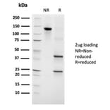 SDS-PAGE - Anti-Growth Hormone Antibody [GH/3155] - BSA and Azide free (A251899) - Antibodies.com