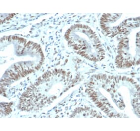 Immunohistochemistry - Anti-FOXP1 Antibody [FOXP1/44R] - BSA and Azide free (A251901) - Antibodies.com