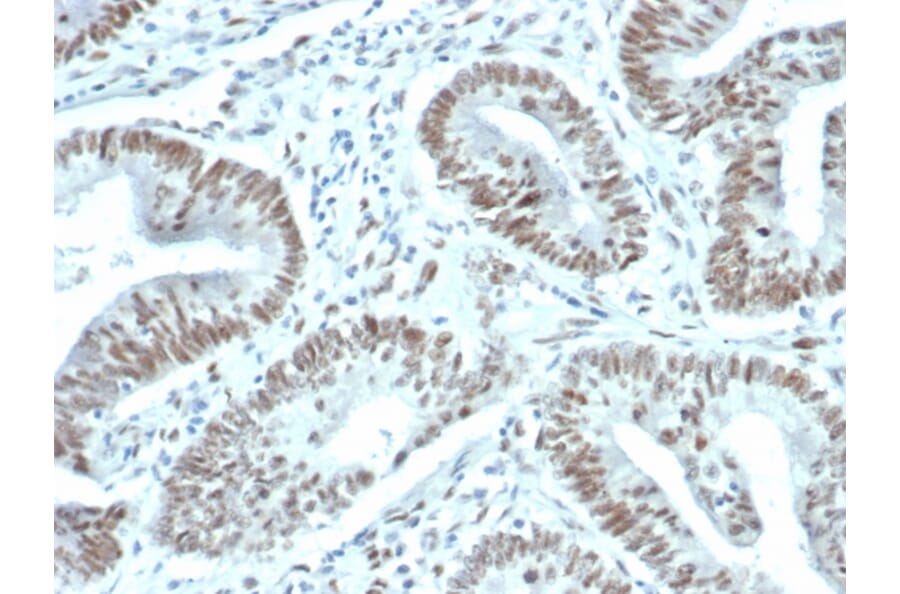 Immunohistochemistry - Anti-FOXP1 Antibody [FOXP1/44R] - BSA and Azide free (A251901) - Antibodies.com