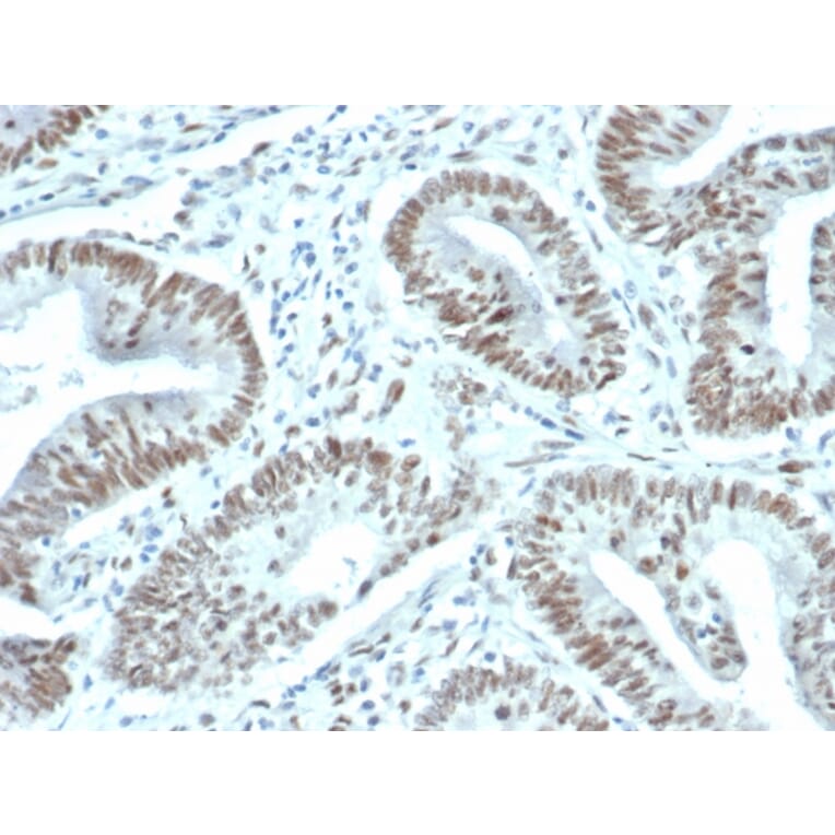 Immunohistochemistry - Anti-FOXP1 Antibody [FOXP1/44R] - BSA and Azide free (A251901) - Antibodies.com