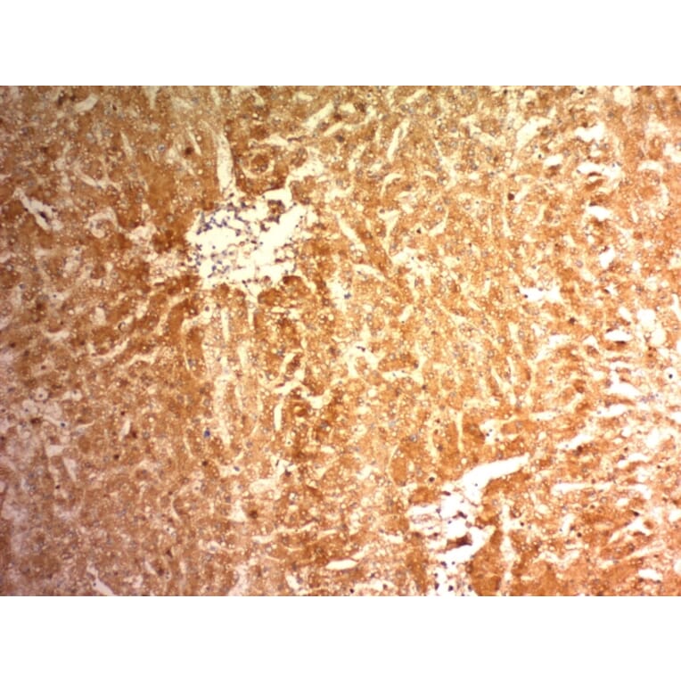 Immunohistochemistry - Anti-Glypican 3 Antibody [1G12] - BSA and Azide free (A251909) - Antibodies.com