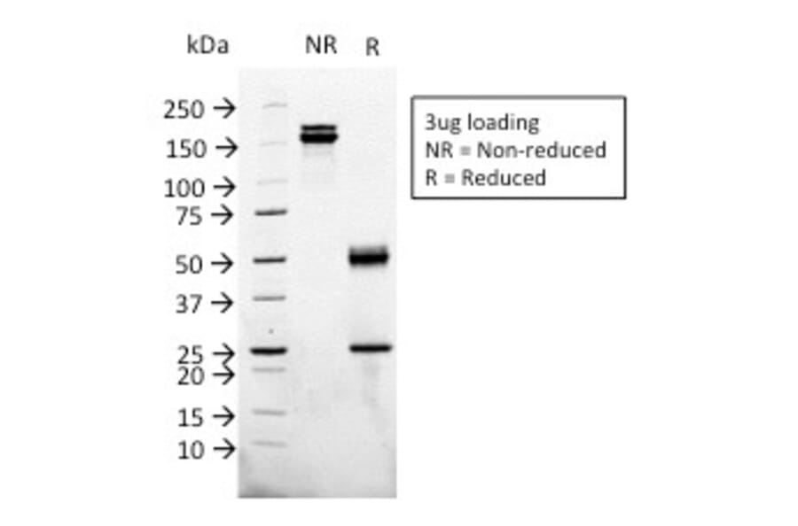 SDS-PAGE - Anti-Glypican 3 Antibody [1G12] - BSA and Azide free (A251909) - Antibodies.com